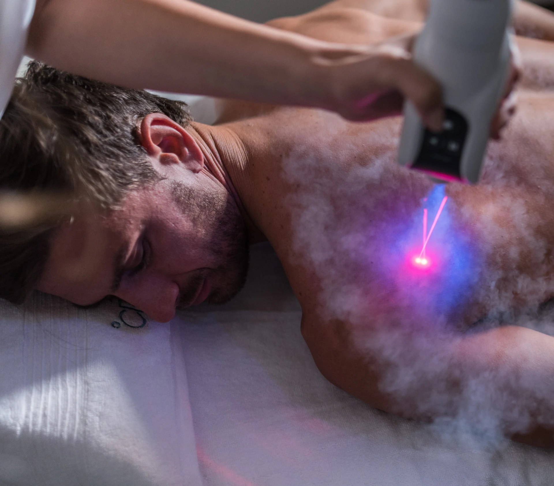 Practitioner directing a handheld targeted cryotherapy wand across a client's shoulder as cold vapor spreads over the skin